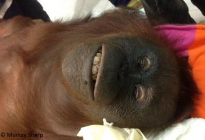 Rosemary's face before surgery on the operating room table